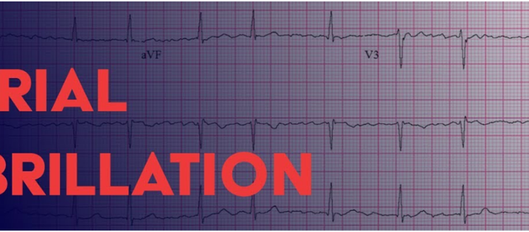 What Are The Treatments Available For Atrial Fibrillation? - Fitness ...