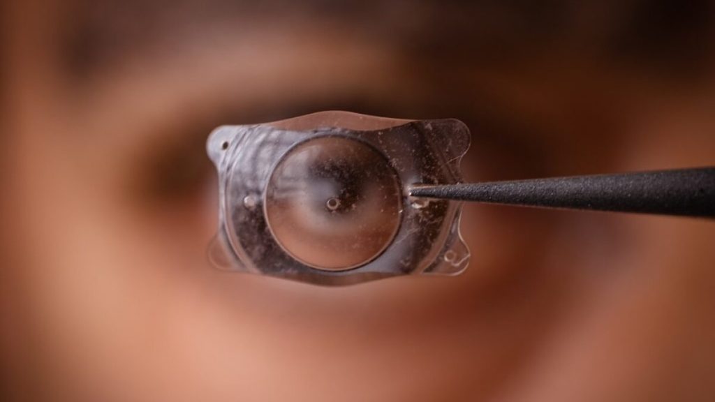 Comparative Insights: Understanding the Differences Between ICL and RLE Procedures