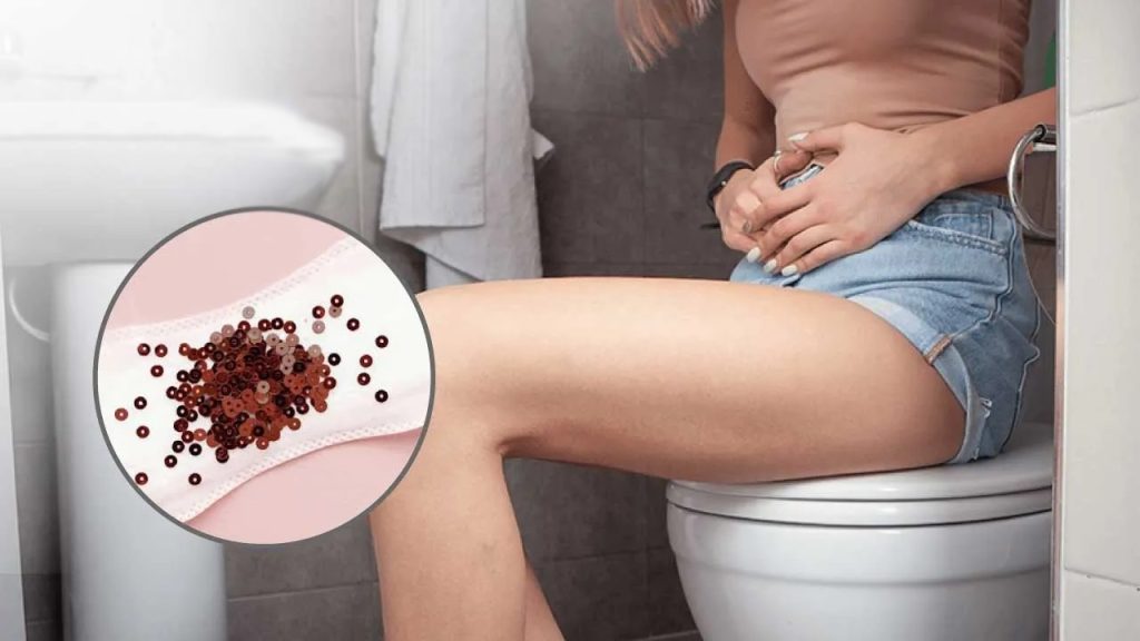 Brown Discharge During Pregnancy