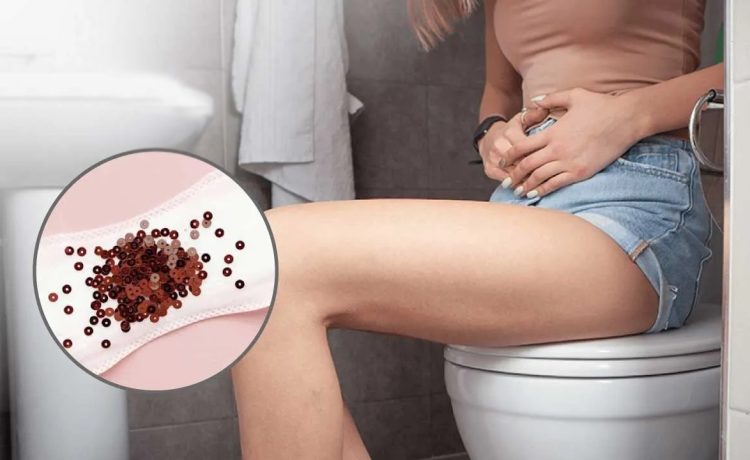 Brown Discharge During Pregnancy