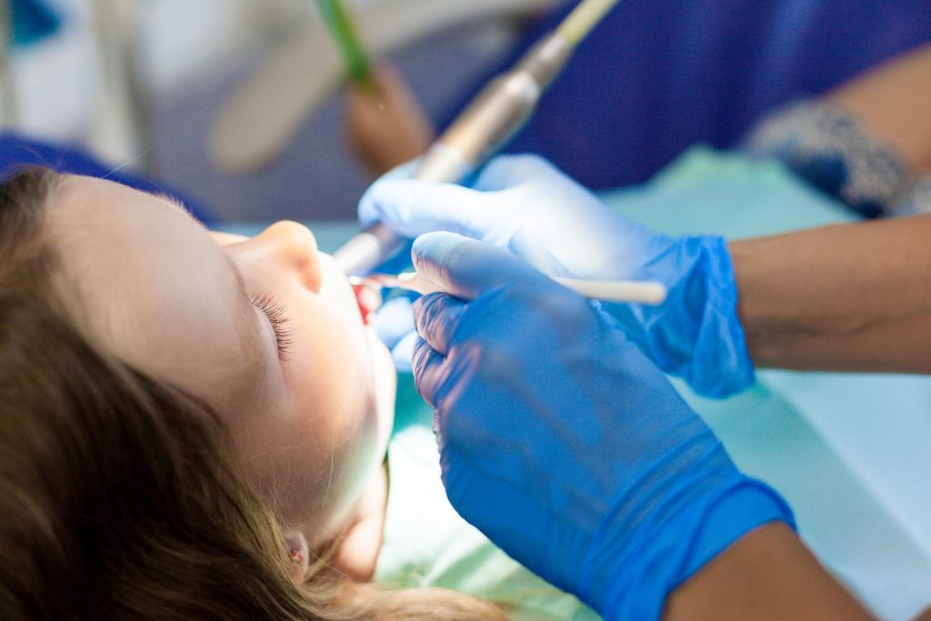 5 Signs You Need a West Vancouver Dentist
