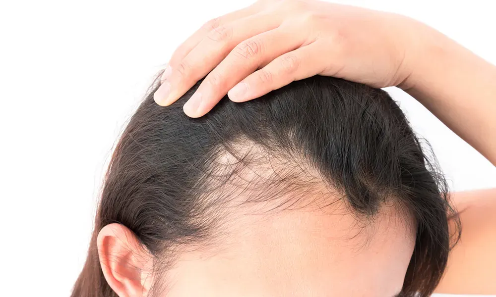Why scalp evaluation is gaining popularity among cancer survivors?