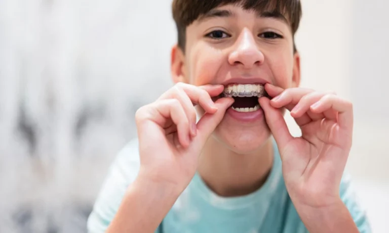 Early Interceptive Orthodontics: Guiding Growth Instead Of Just Moving Teeth