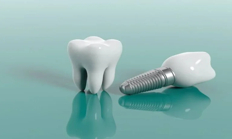 How Preventive Dentistry Safeguards Your Investment In A Smile Makeover