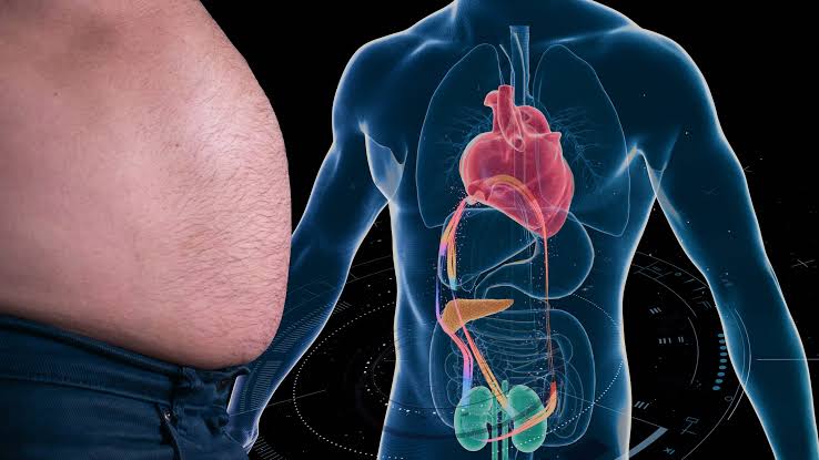 Metabolic Syndrome: Why Waist, BP and Sugar Are Connected