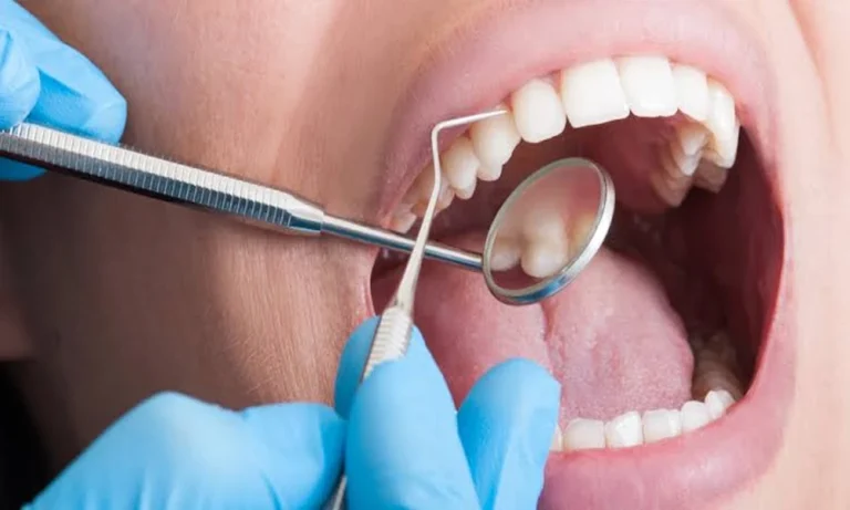 What Parents Should Know About Pediatric Dental Care After Tonsil Or Adenoid Surgery